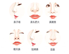 北京善诚卉张维娜院长做